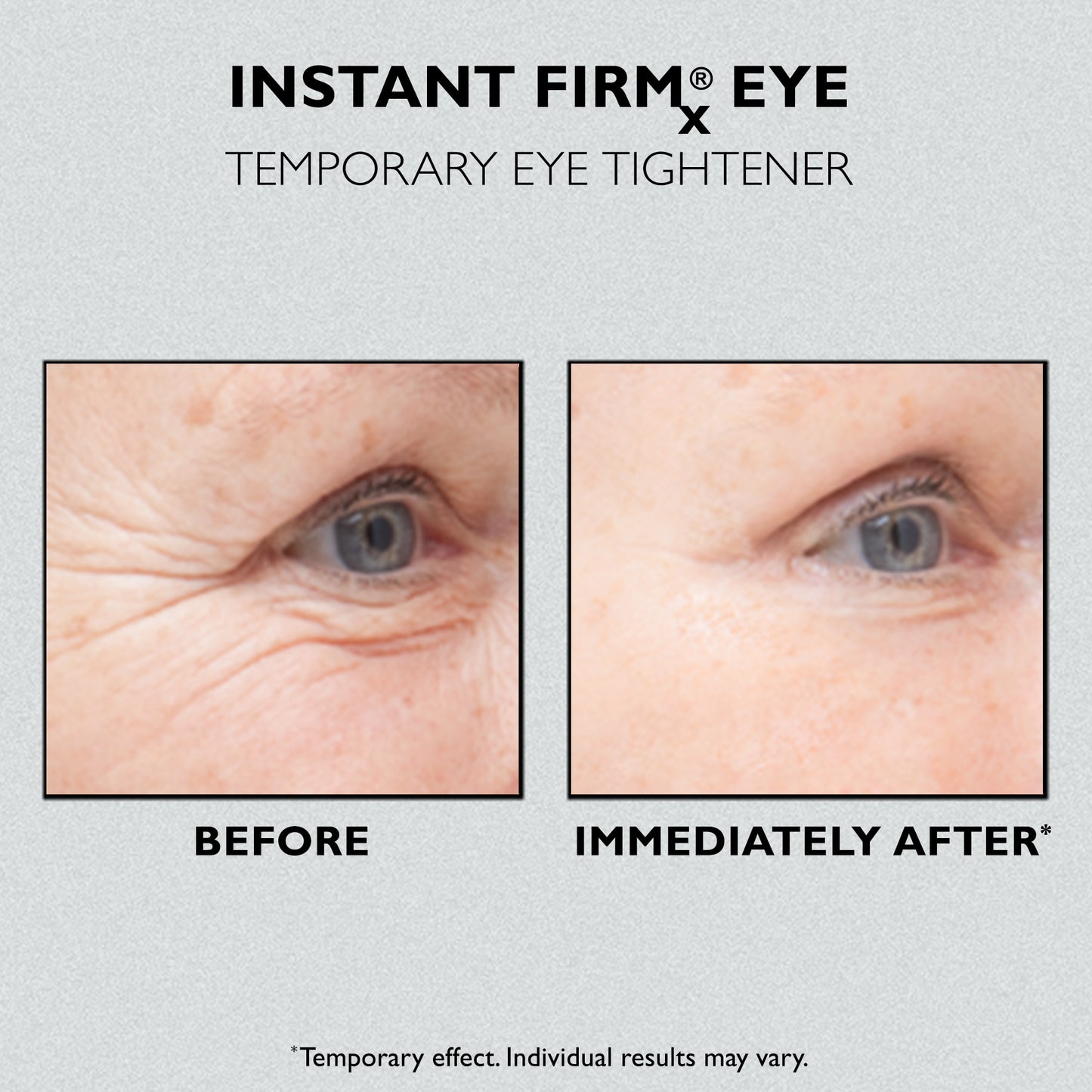 Peter Thomas Roth - Instant FirmX® Temporary Eye Tightener 30 ml